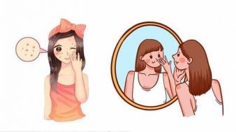 Nếu con bạn bị mụn trứng cá ở tuổi dậy thì, cha mẹ không nên bận tâm, những lời khuyên này sẽ giúp bạn Nếu con bạn bị mụn trứng cá ở tuổi dậy thì, cha mẹ không nên bận tâm, những lời khuyên này sẽ giúp bạn